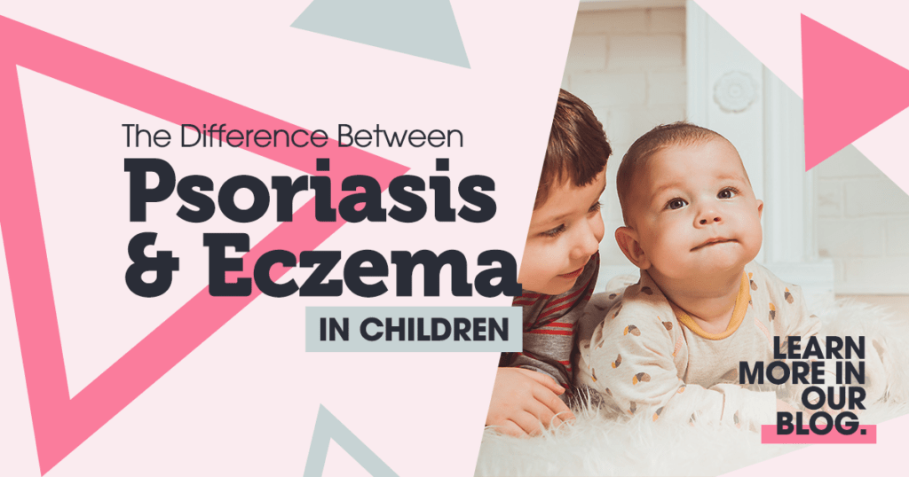 The Difference Between Psoriasis and Eczema in Children