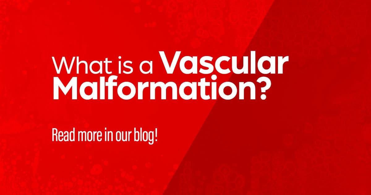 Vascular malformation, clinical research