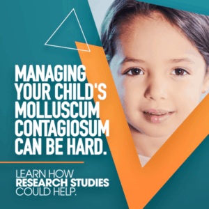 Managing molluscum contagiosum