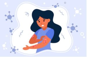 Cartoon image of young woman scratching red scabs covering her arms.