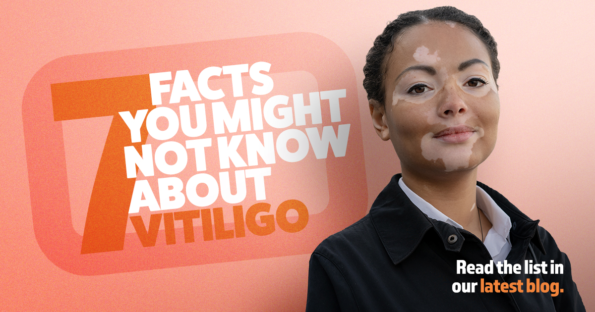 7 facts you might not know about vitiligo. Read the list in our latest blog.