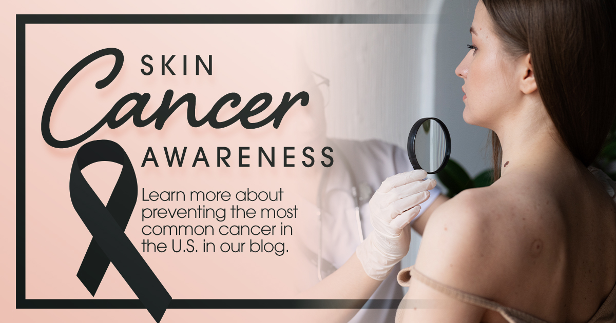 Skin Cancer Awareness - Learn more about preventing the most common cancer in the U.S. in our blog.