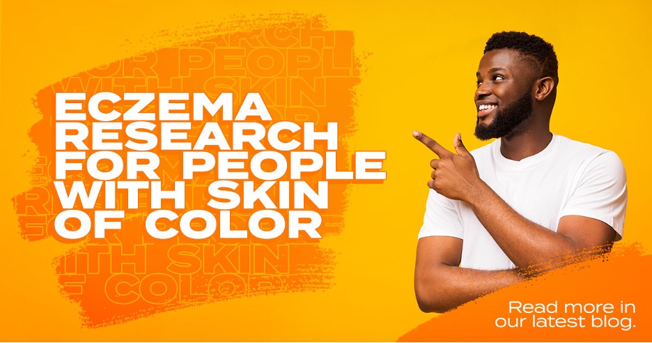 Eczema research for people with skin of color. Read more about diversity in dermatology in our blog.