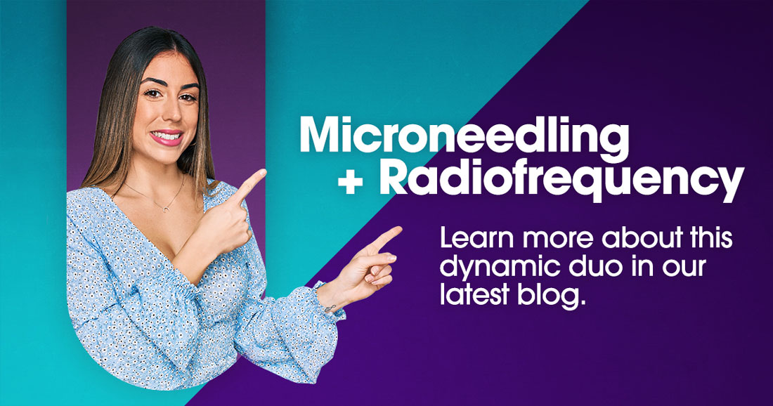 Exion Microneedling and Radiofrequency