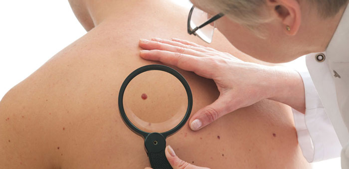 Skin Cancer Removal
